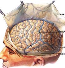 【症状】脑梗塞有前兆 当心这7个症状(图1)