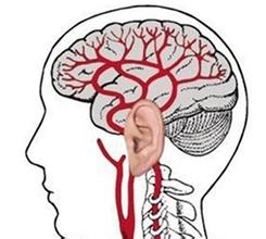 【检查】血栓形成的诊断检查方法有哪些(图1) 【检查】血栓形成的诊断检查方法有哪些(图1)