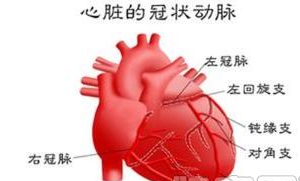 【病因】冠心病的病因、症状及营养调理(图1) 【病因】冠心病的病因、症状及营养调理(图1)