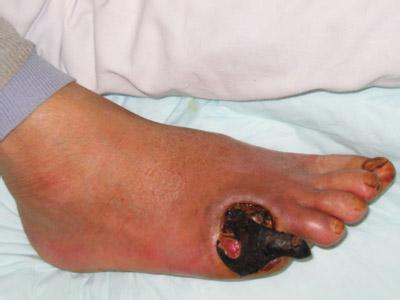 【预防】糖尿病并发症预防-可以从补肾入手!(图1) 【预防】糖尿病并发症预防-可以从补肾入手!(图1)